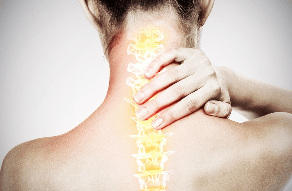 Osteocondrosis de la columna